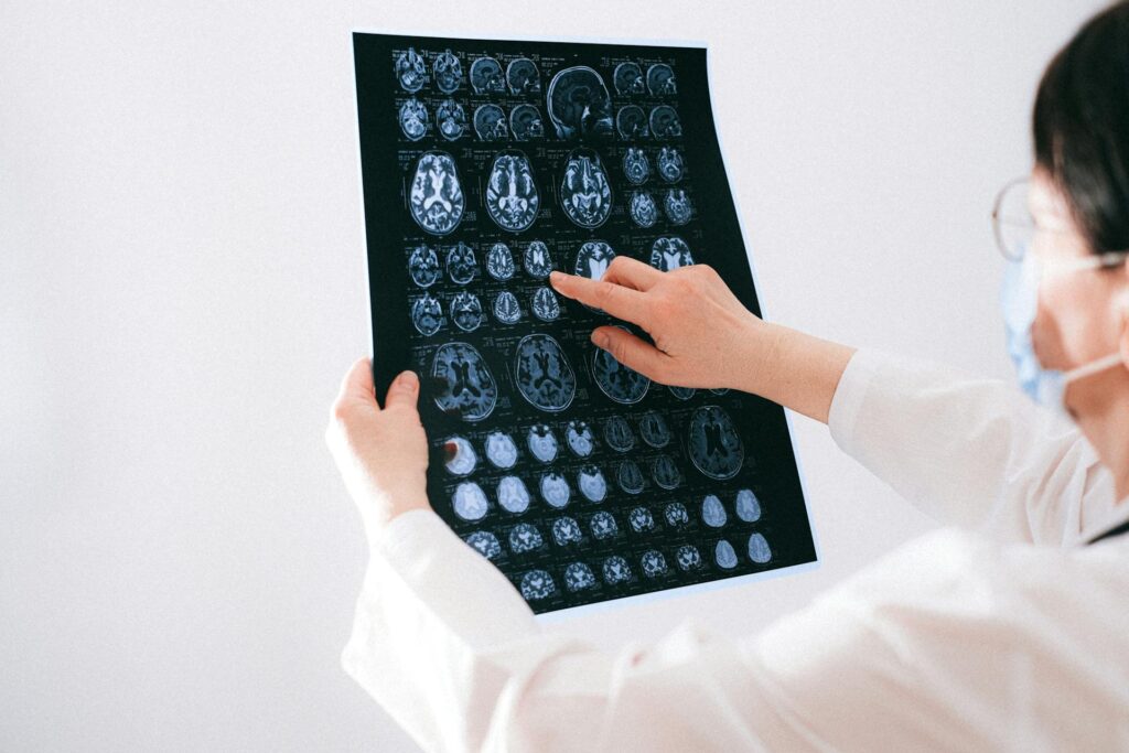 Neurologists